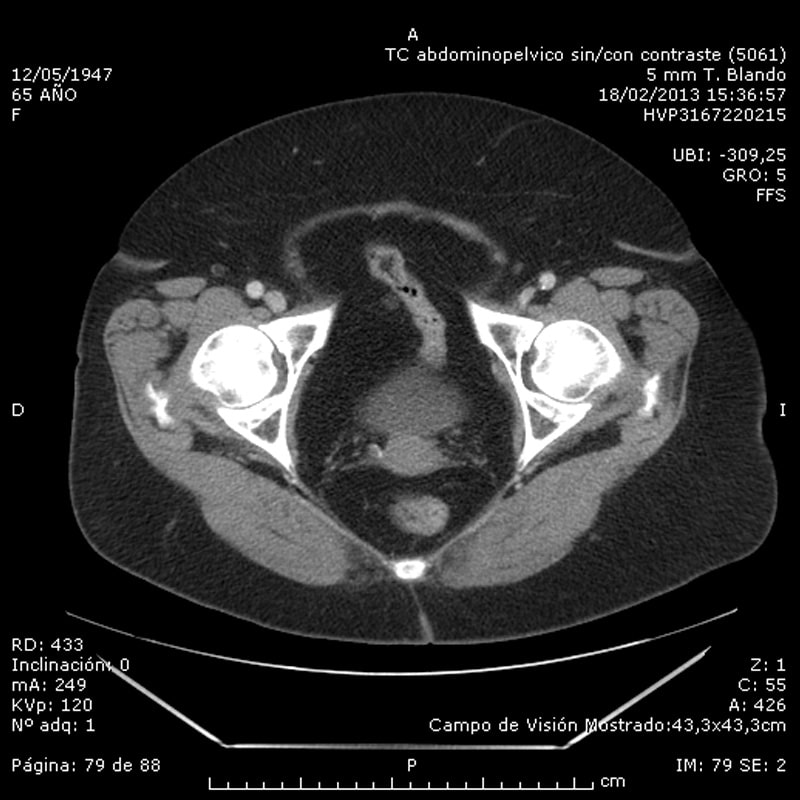 Emergency diagnosis challenge: abdominal pain, surgical?