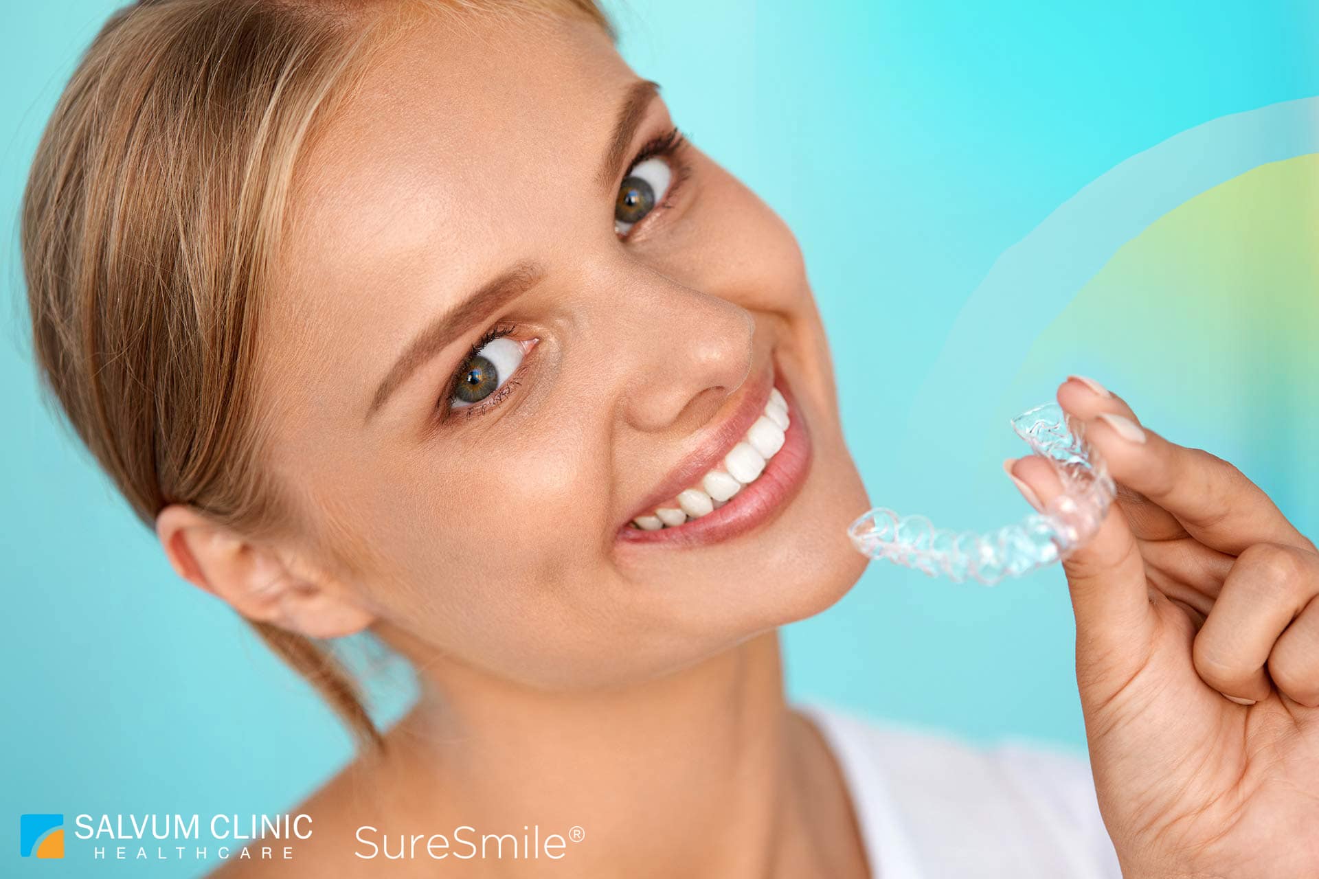 Sure Smile Aligner