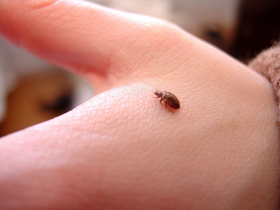 bedbug bites