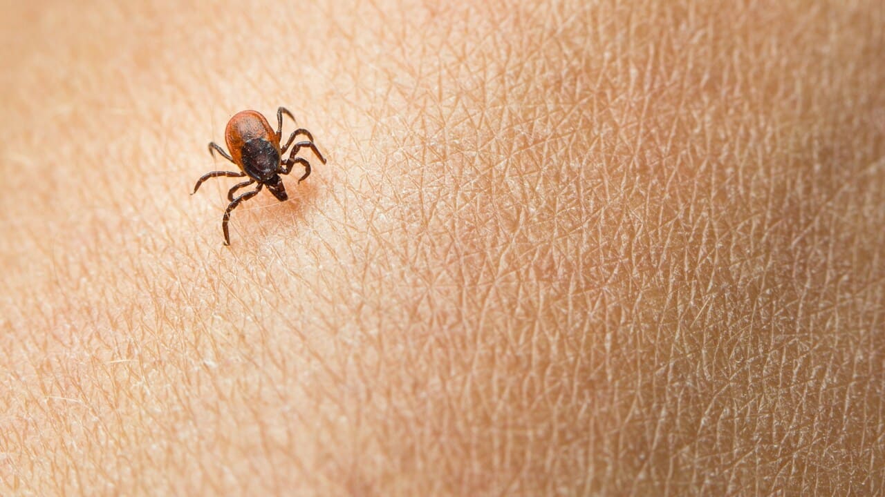 Tick bite